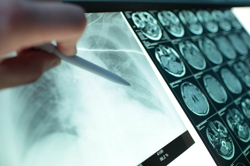 Medical-imaging-1.jpg